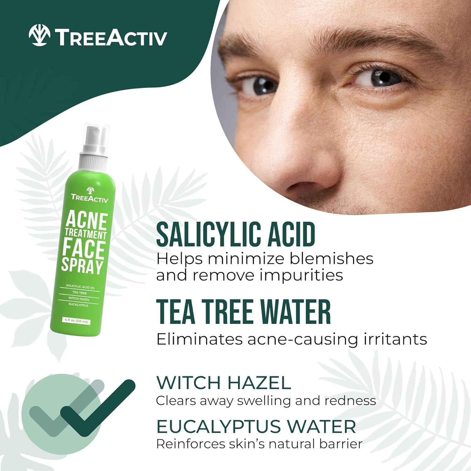 Acne Face Spray, 4 Fl Oz Facial Spray with Witch Hazel, Salicylic Acid for Acne Prone and Oily Skin, for Hormonal, Severe Cystic Acne, Skin Clearing Toner, 1000 Sprays