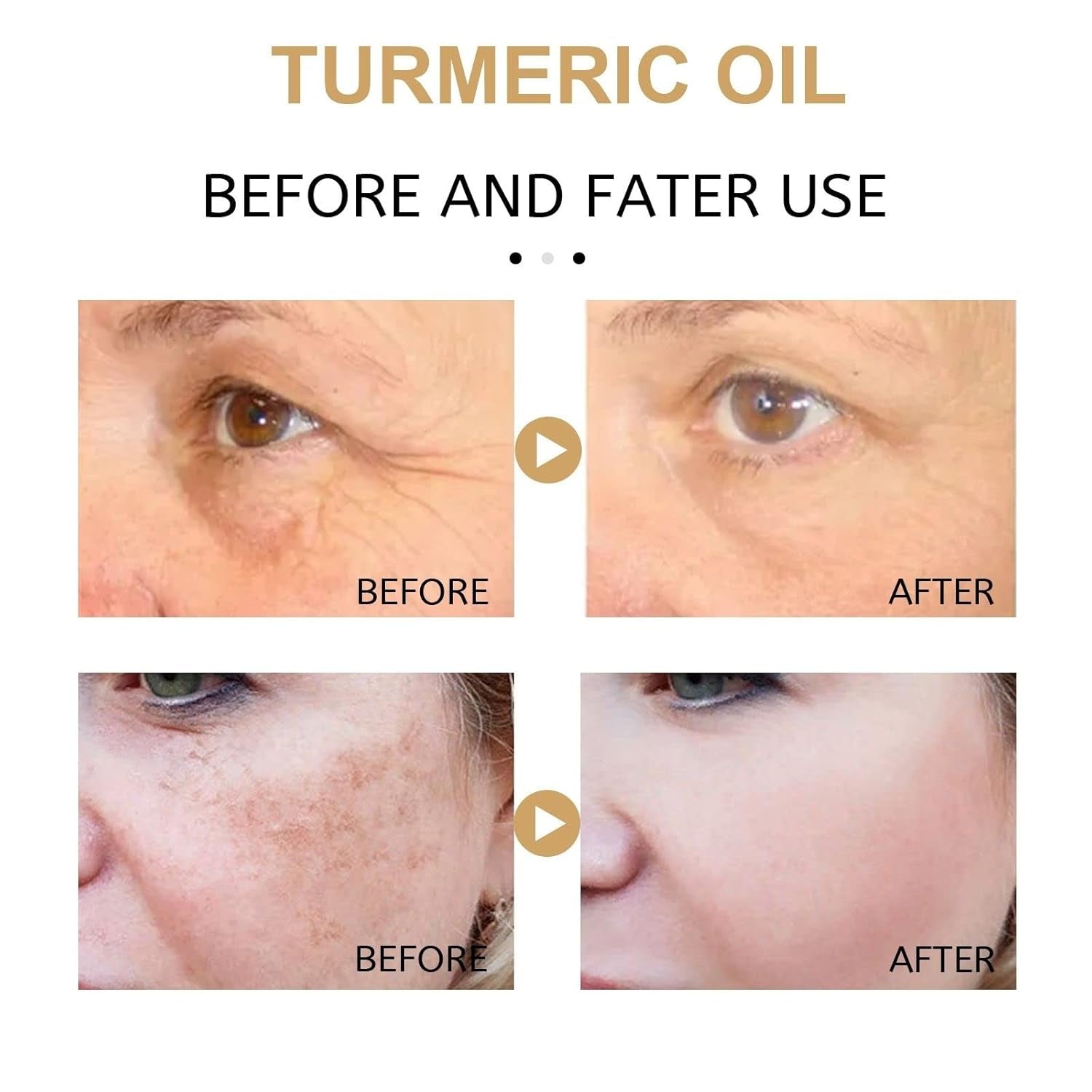 2 Pack Turmeric Dark Spot Corrector Serum, Natural Turmeric Dark Spot Corrector Serum for Face, Skin Care Moisturizing Repair (30Ml/1.01 F.Oz)