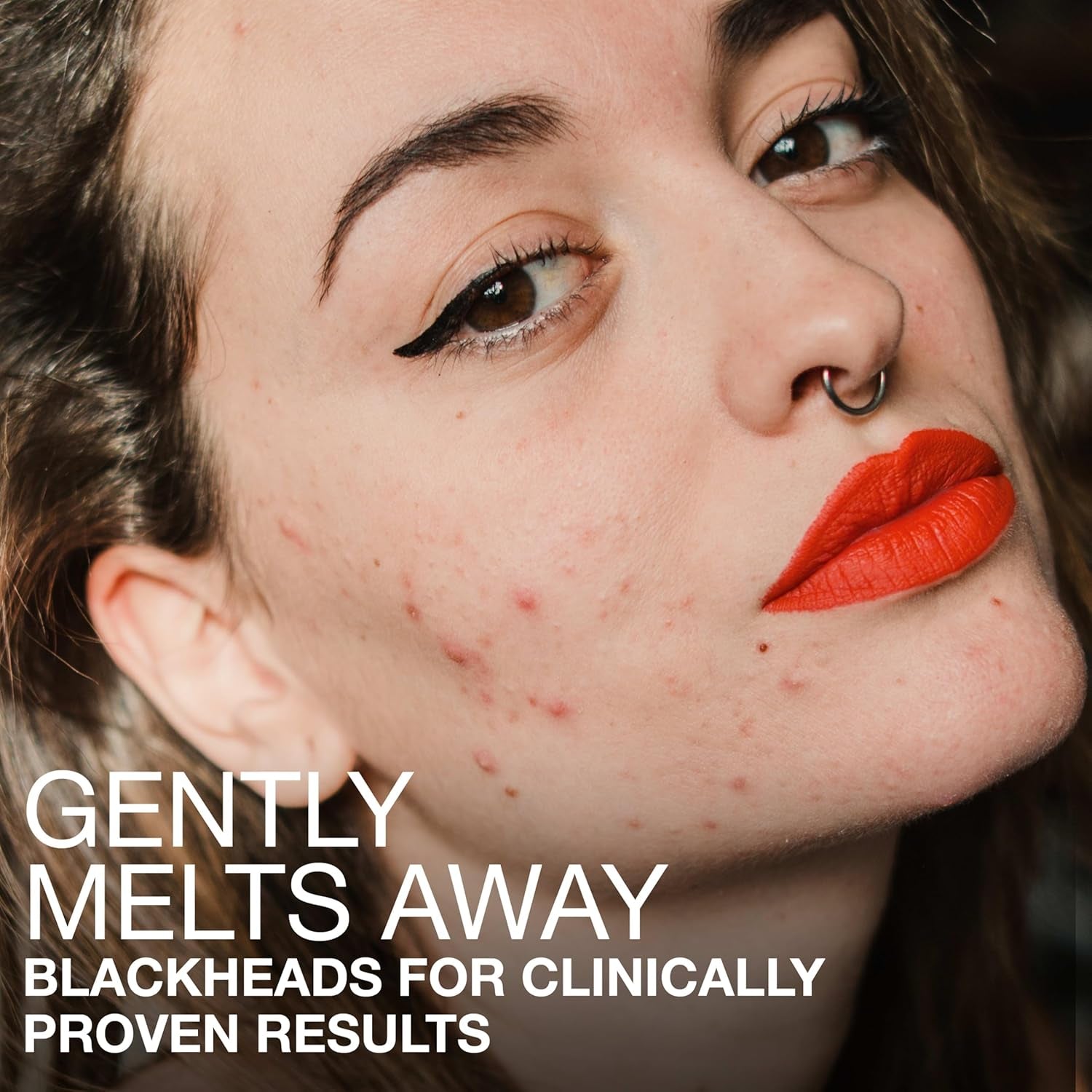 Stubborn Blackheads Daily Acne Facial Serum with Salicylic, Glycolic, Polyhydroxy & Mandelic Acids, Oil-Free Face Serum for Acne-Prone Skin to Help Clear Clogged Pores, 1 Fl. Oz