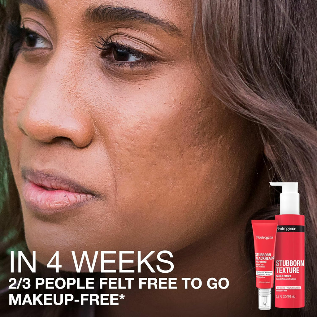 Stubborn Blackheads Daily Acne Facial Serum with Salicylic, Glycolic, Polyhydroxy & Mandelic Acids, Oil-Free Face Serum for Acne-Prone Skin to Help Clear Clogged Pores, 1 Fl. Oz